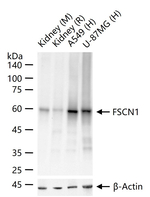Fascin Antibody in Western Blot (WB)