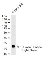 Lambda light chain Antibody in Western Blot (WB)