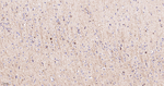 NDRG1 Antibody in Immunohistochemistry (Paraffin) (IHC (P))