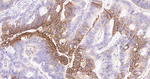 NDRG1 Antibody in Immunohistochemistry (Paraffin) (IHC (P))