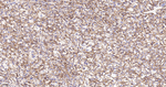 NDRG1 Recombinant Rabbit Monoclonal Antibody (5D1)