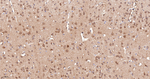 HPRT1 Antibody in Immunohistochemistry (Paraffin) (IHC (P))