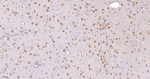 HPRT1 Antibody in Immunohistochemistry (Paraffin) (IHC (P))