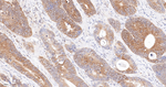 HPRT1 Antibody in Immunohistochemistry (Paraffin) (IHC (P))