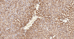 HPRT1 Antibody in Immunohistochemistry (Paraffin) (IHC (P))