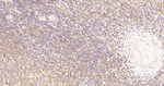 HPRT1 Antibody in Immunohistochemistry (Paraffin) (IHC (P))