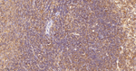 HPRT1 Antibody in Immunohistochemistry (Paraffin) (IHC (P))