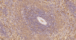 HPRT1 Antibody in Immunohistochemistry (Paraffin) (IHC (P))
