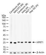 HPRT1 Antibody in Western Blot (WB)