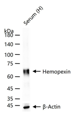 Hemopexin Recombinant Rabbit Monoclonal Antibody (10C4)