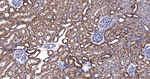 CYP2D6 Antibody in Immunohistochemistry (Paraffin) (IHC (P))