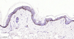 Langerin Antibody in Immunohistochemistry (Paraffin) (IHC (P))
