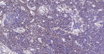 LCK Antibody in Immunohistochemistry (Paraffin) (IHC (P))