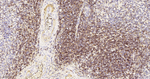 LCK Recombinant Rabbit Monoclonal Antibody (1A8)