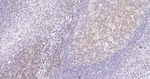 LCK Antibody in Immunohistochemistry (Paraffin) (IHC (P))