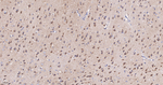 UQCRC2 Antibody in Immunohistochemistry (Paraffin) (IHC (P))