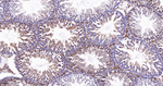 UQCRC2 Antibody in Immunohistochemistry (Paraffin) (IHC (P))