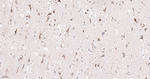 UQCRC2 Antibody in Immunohistochemistry (Paraffin) (IHC (P))