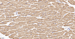 UQCRC2 Antibody in Immunohistochemistry (Paraffin) (IHC (P))