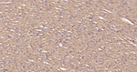 UQCRC2 Antibody in Immunohistochemistry (Paraffin) (IHC (P))