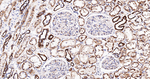UQCRC2 Antibody in Immunohistochemistry (Paraffin) (IHC (P))
