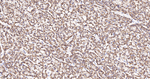 UQCRC2 Antibody in Immunohistochemistry (Paraffin) (IHC (P))