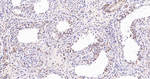 UQCRC2 Antibody in Immunohistochemistry (Paraffin) (IHC (P))