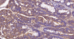 EEF2 Antibody in Immunohistochemistry (Paraffin) (IHC (P))