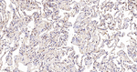 EEF2 Antibody in Immunohistochemistry (Paraffin) (IHC (P))