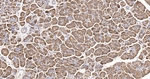 EEF2 Antibody in Immunohistochemistry (Paraffin) (IHC (P))