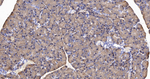 EEF2 Antibody in Immunohistochemistry (Paraffin) (IHC (P))