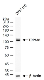 TRPM8 Recombinant Rabbit Monoclonal Antibody (4G6)