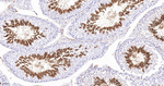 ACE Recombinant Rabbit Monoclonal Antibody (17G16)