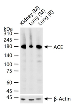 ACE Antibody in Western Blot (WB)