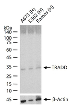TRADD Recombinant Rabbit Monoclonal Antibody (2C10)