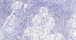 RAP80 Antibody in Immunohistochemistry (Paraffin) (IHC (P))