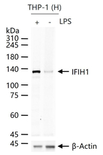 MDA5 Recombinant Rabbit Monoclonal Antibody (5B1)