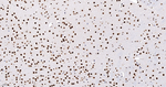 Histone Macro-H2A.1 Antibody in Immunohistochemistry (Paraffin) (IHC (P))