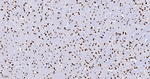 Histone Macro-H2A.1 Antibody in Immunohistochemistry (Paraffin) (IHC (P))
