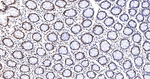 Histone Macro-H2A.1 Antibody in Immunohistochemistry (Paraffin) (IHC (P))