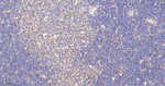 MAD2L2 Antibody in Immunohistochemistry (Paraffin) (IHC (P))