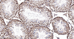 MAD2L2 Antibody in Immunohistochemistry (Paraffin) (IHC (P))