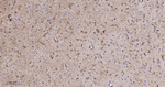 PAK2 Antibody in Immunohistochemistry (Paraffin) (IHC (P))