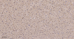 PAK2 Antibody in Immunohistochemistry (Paraffin) (IHC (P))