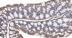 PAK2 Antibody in Immunohistochemistry (Paraffin) (IHC (P))