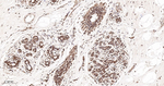 PAK2 Antibody in Immunohistochemistry (Paraffin) (IHC (P))