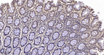 PAK2 Antibody in Immunohistochemistry (Paraffin) (IHC (P))