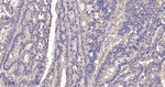 PAK2 Antibody in Immunohistochemistry (Paraffin) (IHC (P))