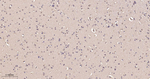 PAK2 Antibody in Immunohistochemistry (Paraffin) (IHC (P))
