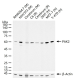 PAK2 Antibody in Western Blot (WB)